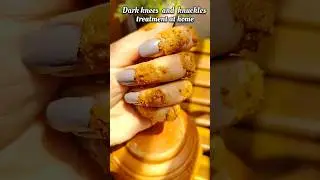 🤫How to lighten dark knees and knuckles in one week l#trending #viral #shorts #ashortaday