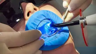 Implantologie dentaire : la solution pour remplacer vos dents manquantes ?