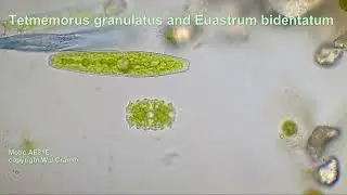 Tetmemorus and Euastrum, Desmids