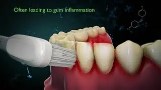 Toothbrush new technology 2021 by Silk'n (Medical Device 3D Animation)