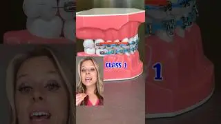 RUBBER BAND PATTERNS EXPLAINED BY AN ORTHODONTIST 🦷 HOW BRACES WORK EXPLANATION