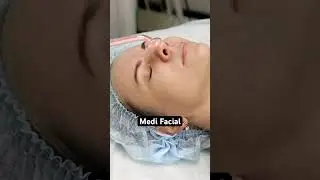 Medi Facial - Skin Rejuvenation #skincare #viral #shorts