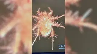 Red velvet mite and Spider mite insect facts!