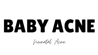 Newborn Baby Rashes on Face Remedy | Baby Acne Treatment | Natural Cream