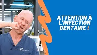 Douleur, gonflement, fi&egrave;vre ? Attention &agrave; l&rsquo;infection dentaire !