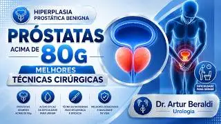Qual a melhor cirurgia para pr&oacute;statas acima de 80 gramas? Dr. Artur Beraldi Urologista