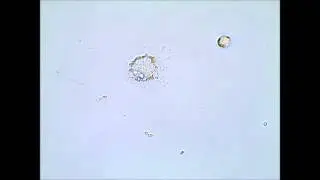 MH-S phagocytosis