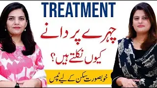 Why Pimples Appear & How to Stop Them | Dr. Zahra Shehzad
