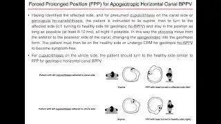 Forced Prolonged Position (FPP) for Left Apogeotropic Horizontal Canal BPPV