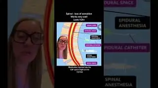#stitch w/ @z00mie. What&rsquo;s the difference between spinal & #epidural anesthesia? #childbirth #shorts