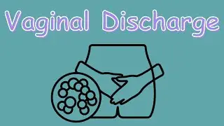 Vaginal Discharge: Normal vs. Abnormal