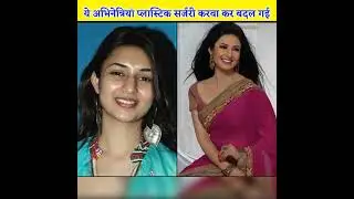 Top-5 टीवी की ये अभिनेत्रियां प्लास्टिक सर्जरी करवा कर क्या से क्या हो गई....