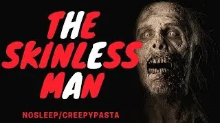 The Skinless Man | CreepyPasta | NoSleep