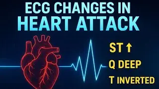 ECG Changes in Heart Attack Explained | ST Elevation, Q Wave, T Inversion | Full ECG Interpretation