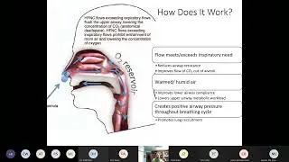Kevin Collopy - High Flow Nasal Cannula (9/28/2021)