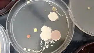 Beauty of bacteria (harmful pathogenic organisms 