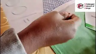 Importance of a tactile embossed diagram for inclusive understanding