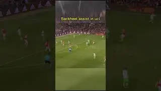 Backheel assist in ucl