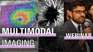 Virtual Grand Rounds with Dr. Saeedi: Optimize Your Multimodal Imaging Approach