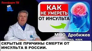 Скрытые причины смерти от инсульта в России.
