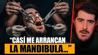 Acquaviva regresa contando la PESADILLA DENTAL que pas&oacute; y explota contra el dentista