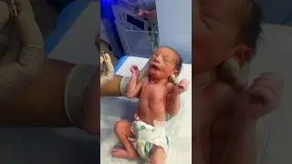 ❤️Just After Birth Oral Vitamin K for Little LBW Baby | Newborn Care Moments🩺❤️🩺