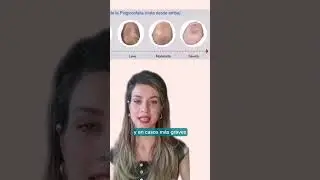 Evita la plagiocefalia en tu beb&eacute; reci&eacute;n nacido