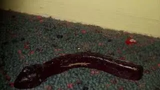 Hairworm
