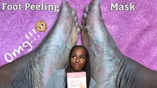 FOOT PEEL MASK REVIEW FOR BABY SOFT FEET