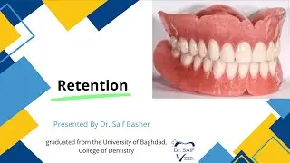 شرح محاضرة بروس مرحلة خامسة  pros Lec retention of complete denture