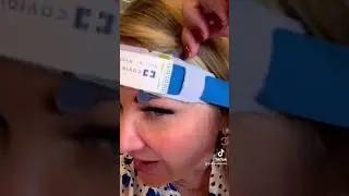 Forehead Oximetry!