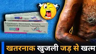 Castor NF Skin Cream