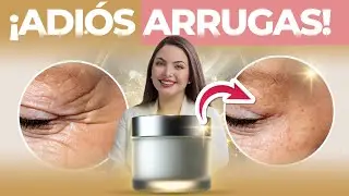 ¿Cremas milagrosas? Dile adiós a las arrugas en minutos