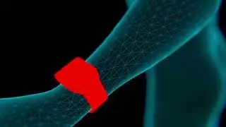 APDM Mobility L﻿ab Validated Gold Standard of Portable Gait Lab for Fast and Accurate Gait Analysis