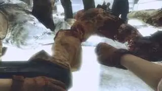 7GreeNs - Zombie (Black Ops 2 Zombie) Edit By Igloo