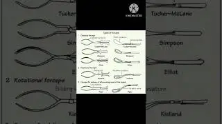Forceps #forceps #obstetricsandgynecology #shortsvideo #shortsviral #ytshorts #nursingstudent