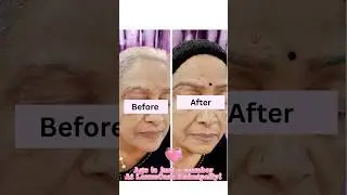 😱 This 60-Year-Old's Eyebrow Transformation Will SHOCK You! #beauty #lexuscare #skincare
