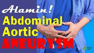 Abdominal Aortic ANEURYSM, Ano ito?  Tagalog Health Tips | Nurse Dianne