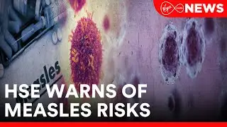 Man dies from first confirmed case of measles in Ireland this year