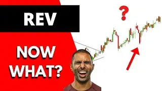 REV Stock 2 July 2022 Technical Analysis And Predictions | Revlon Stock