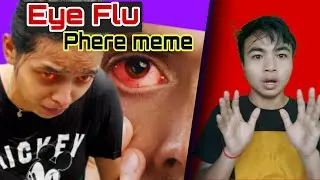 Eye Flu phere meme keso / chere tha Karbi Anglong