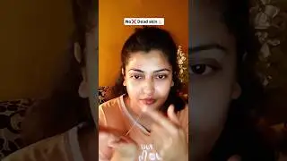 No❌Nose🙏🏻blackheads⚡ | Skincare💖Beauty🎯tips🎀 #blackheads #nose #deadskin #skincare #tips #beauty