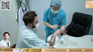 Hair Transplant Thailand Bangkok By ABHRS American Board Doctor | Ultima Hair Center Line:@ultima