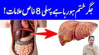 8 Warning Signs of Fatty Liver - Jigar Ki Charbi Ka ilaj