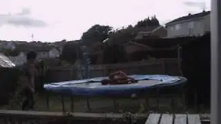 Bad trampoline accident