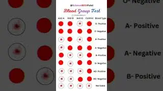 Blood group Test 💉