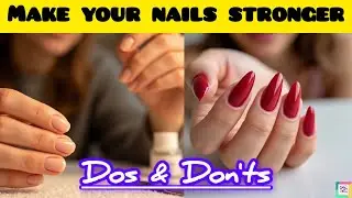 Strong Nails Remedy| Stop Nail Breakage| Tips for Strong Nails| Get Strong Nails