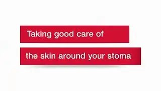 The Cycle of Unhealthy Skin | Hollister Incorporated