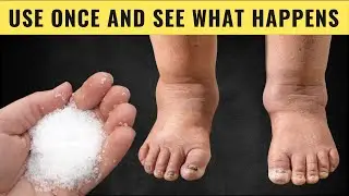Shocking Benefits of Epsom Salt You Didn&rsquo;t Know!