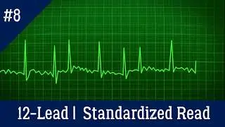 EKG/ECG Interpretation | Section 8: Standardized Reading